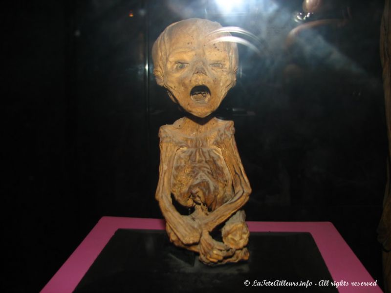La fierté du musée : un foetus de 5 ou 6 mois momifié, la plus petite momie du monde !
